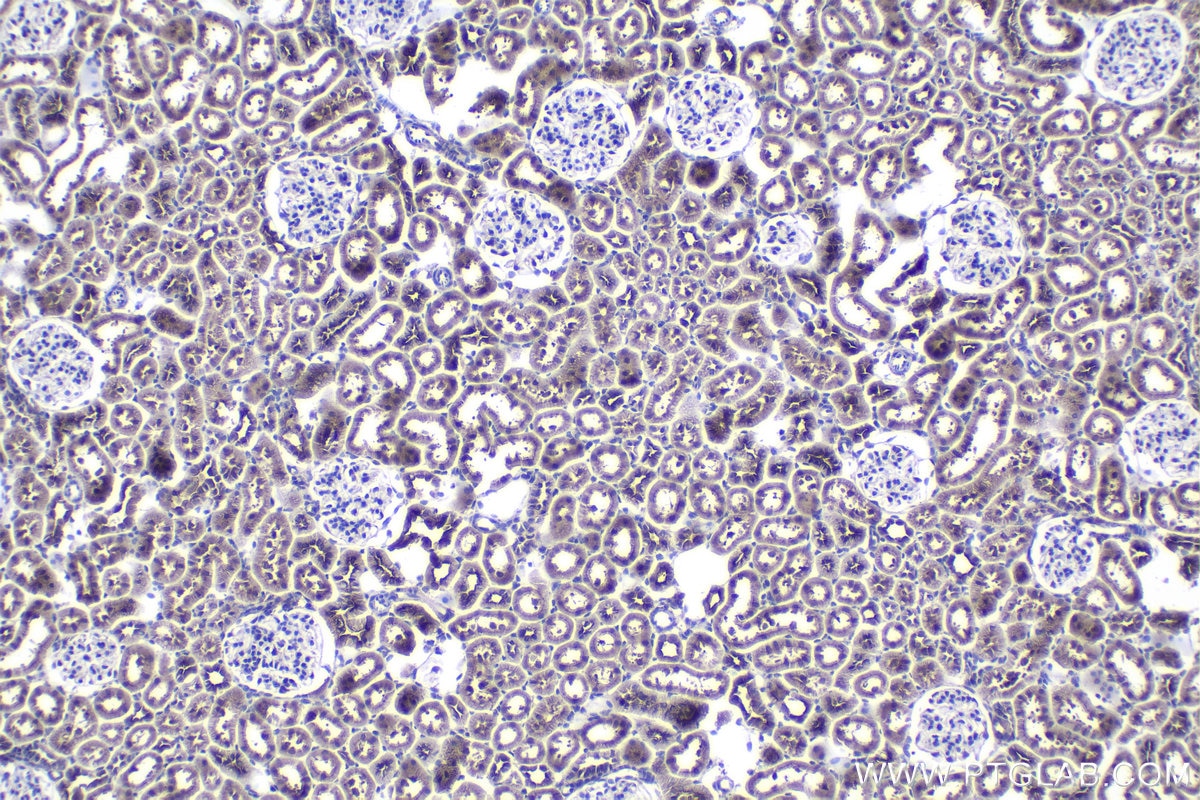 Immunohistochemical analysis of paraffin-embedded rat kidney tissue slide using KHC1148 (SLC25A5 IHC Kit).