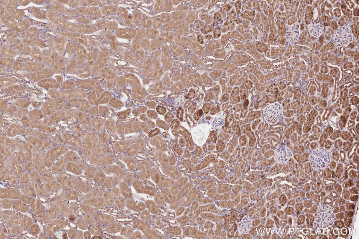 Immunohistochemical analysis of paraffin-embedded rat kidney tissue slide using KHC2583 (SLC30A6/ZNT6 IHC Kit).