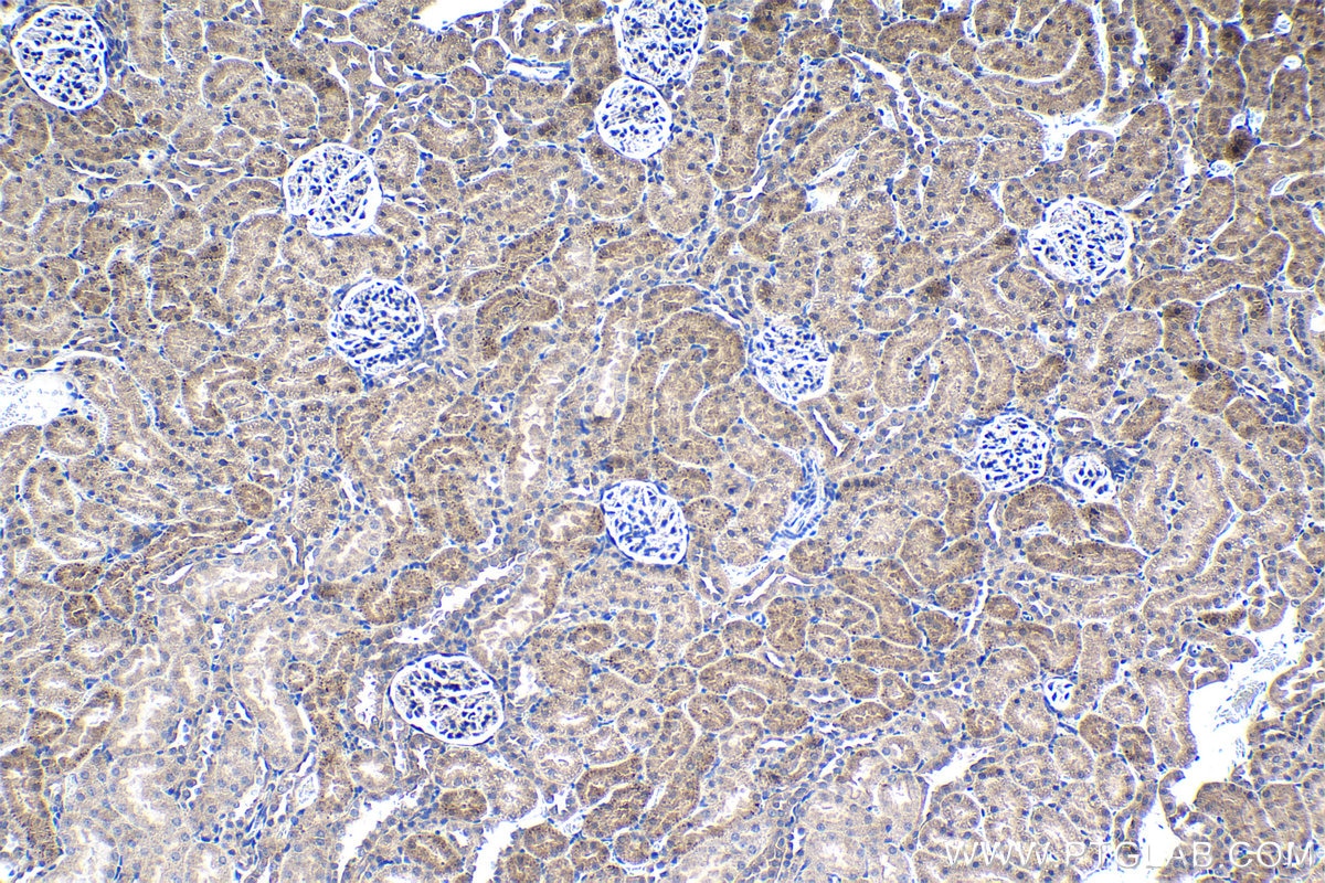 Immunohistochemical analysis of paraffin-embedded rat kidney tissue slide using KHC1215 (SLC38A2 IHC Kit).