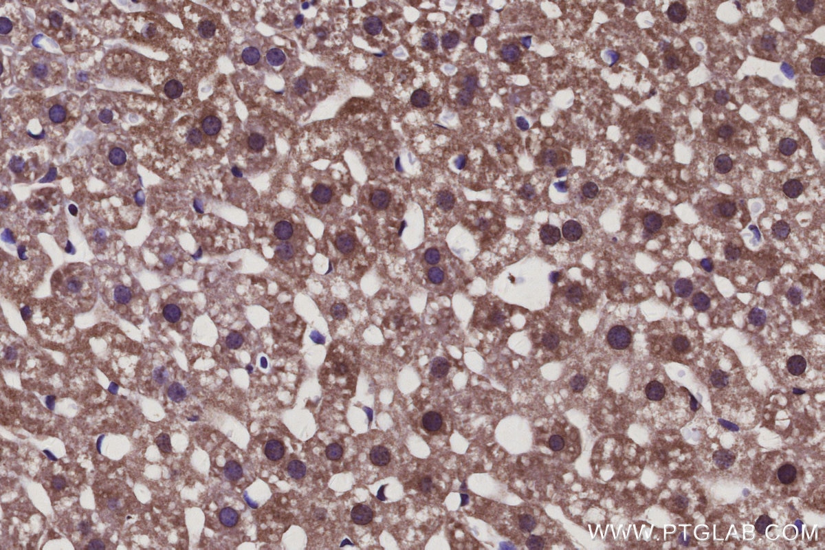 Immunohistochemical analysis of paraffin-embedded mouse liver tissue slide using KHC3114 (SLC39A3 IHC Kit).