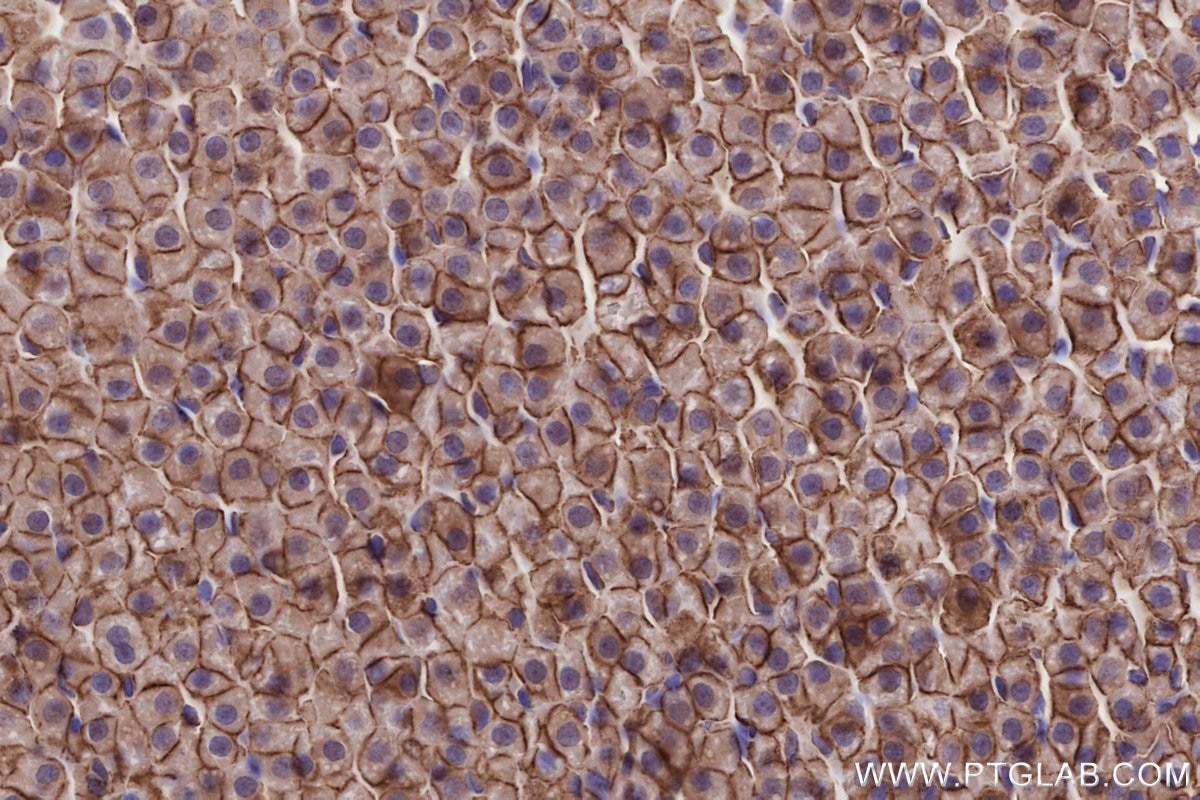Immunohistochemical analysis of paraffin-embedded rat adrenal gland tissue slide using KHC2671 (SLC43A2 IHC Kit).