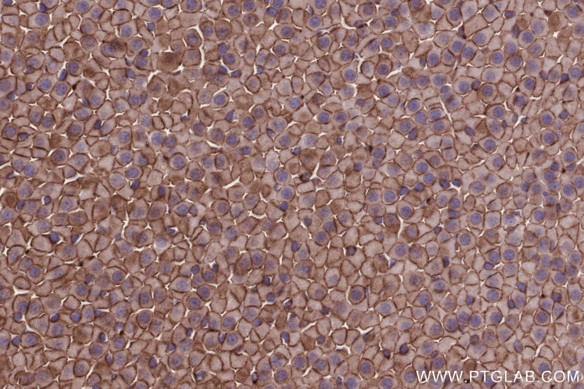 Immunohistochemical analysis of paraffin-embedded mouse adrenal gland tissue slide using KHC2671 (SLC43A2 IHC Kit).
