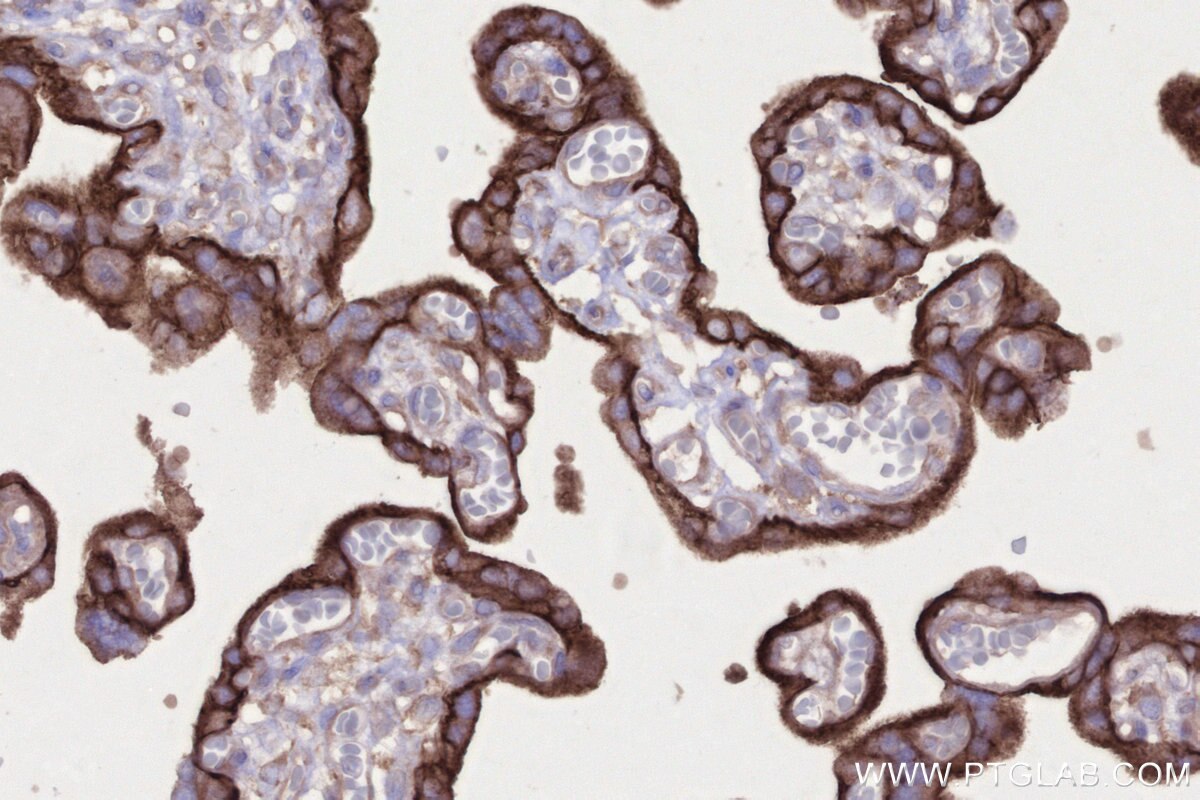 Immunohistochemical analysis of paraffin-embedded human placenta tissue slide using KHC2671 (SLC43A2 IHC Kit).
