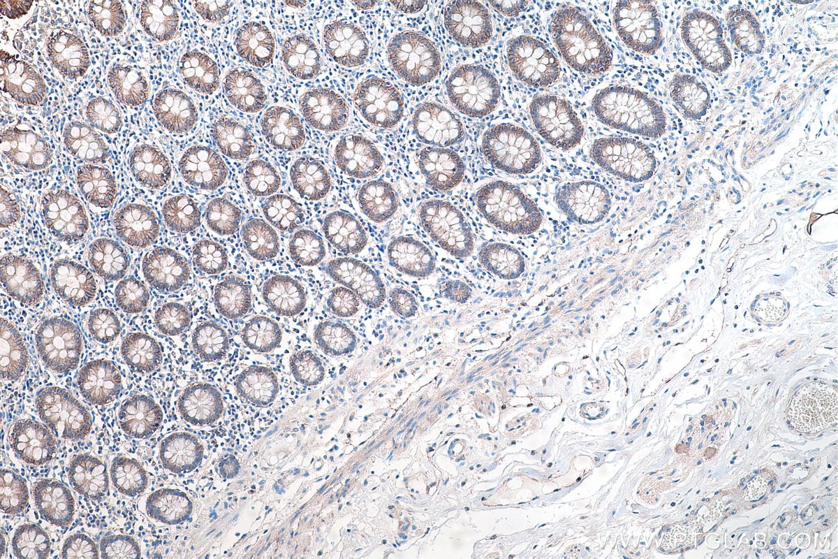 Immunohistochemical analysis of paraffin-embedded human colon tissue slide using KHC0196 (SLC4A4 IHC Kit).