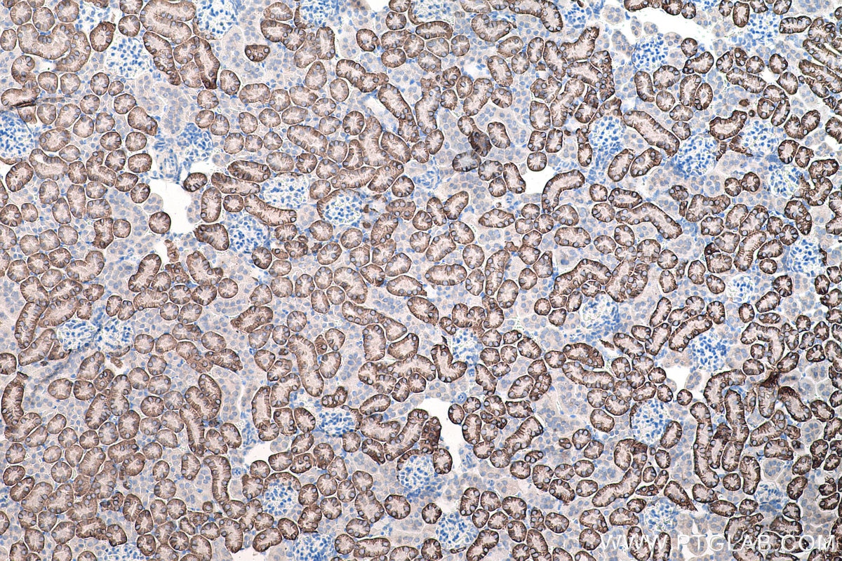 Immunohistochemical analysis of paraffin-embedded mouse kidney tissue slide using KHC0196 (SLC4A4 IHC Kit).