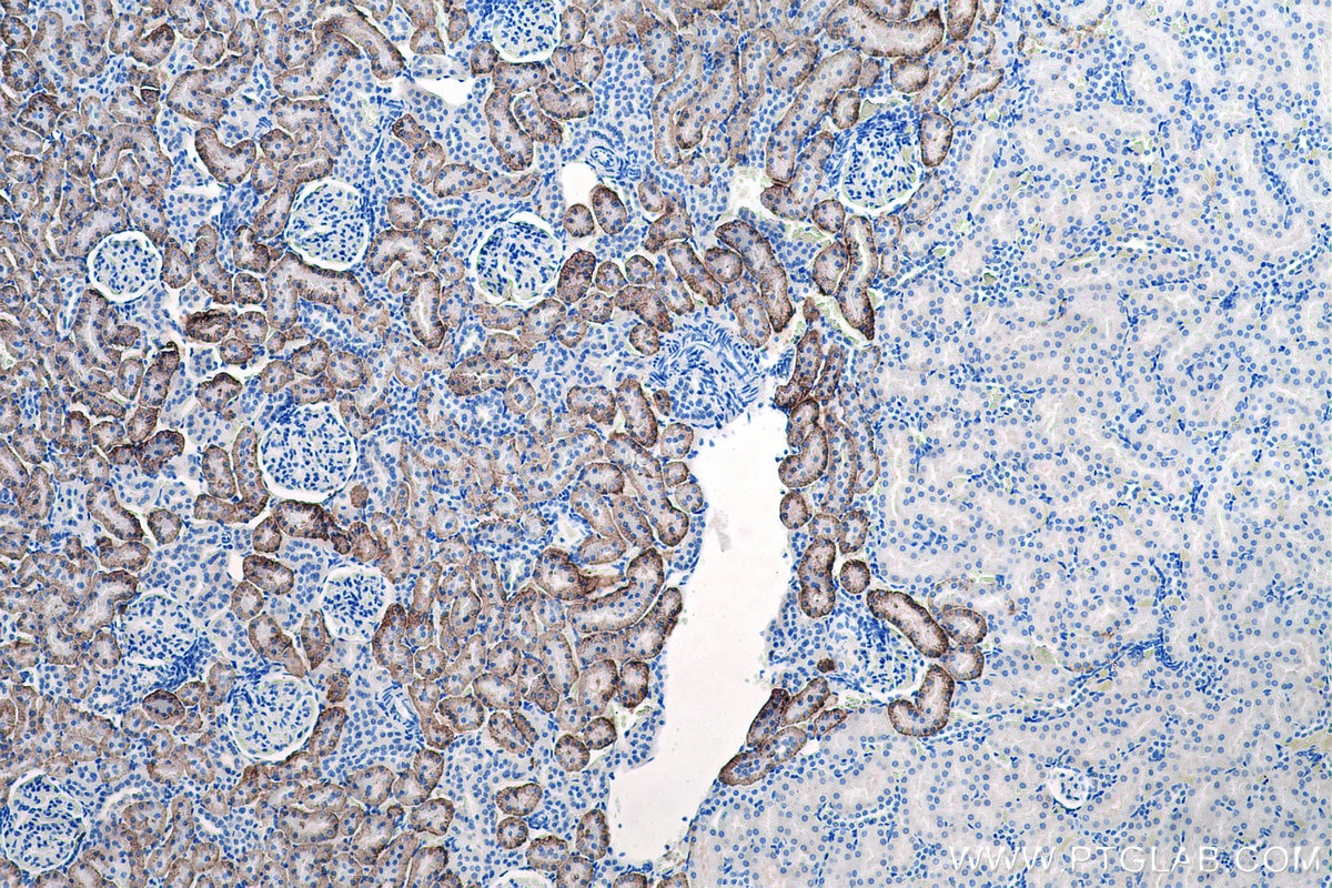 Immunohistochemical analysis of paraffin-embedded rat kidney tissue slide using KHC0196 (SLC4A4 IHC Kit).