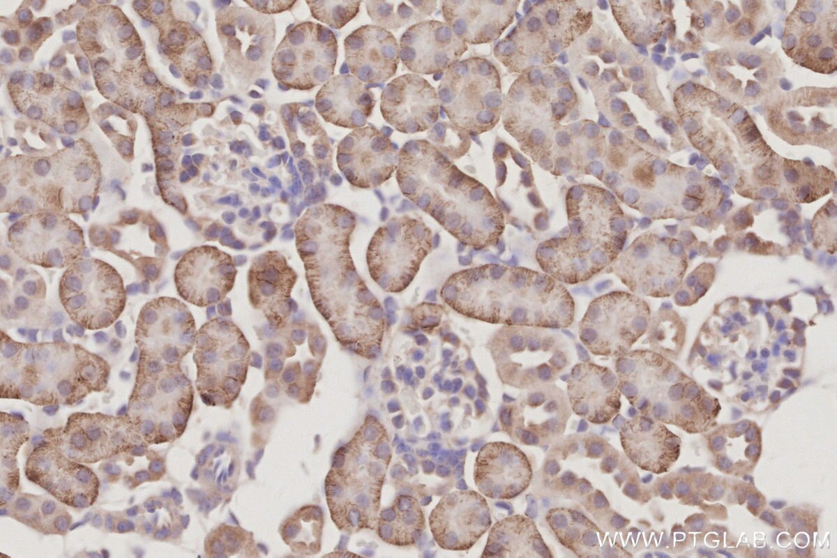 Immunohistochemical analysis of paraffin-embedded mouse kidney tissue slide using KHC3094 (SLC4A7/NBCn1 IHC Kit). Immunohistochemical analysis of paraffin-embedded mouse kidney tissue slide using KHC3094 (SLC4A7/NBCn1 IHC Kit).