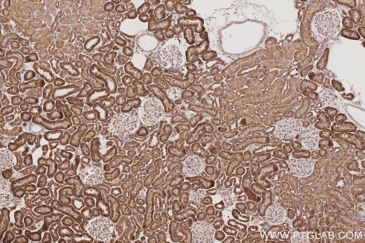 Immunohistochemical analysis of paraffin-embedded rat kidney tissue slide using KHC3094 (SLC4A7/NBCn1 IHC Kit). Immunohistochemical analysis of paraffin-embedded rat kidney tissue slide using KHC3094 (SLC4A7/NBCn1 IHC Kit).
