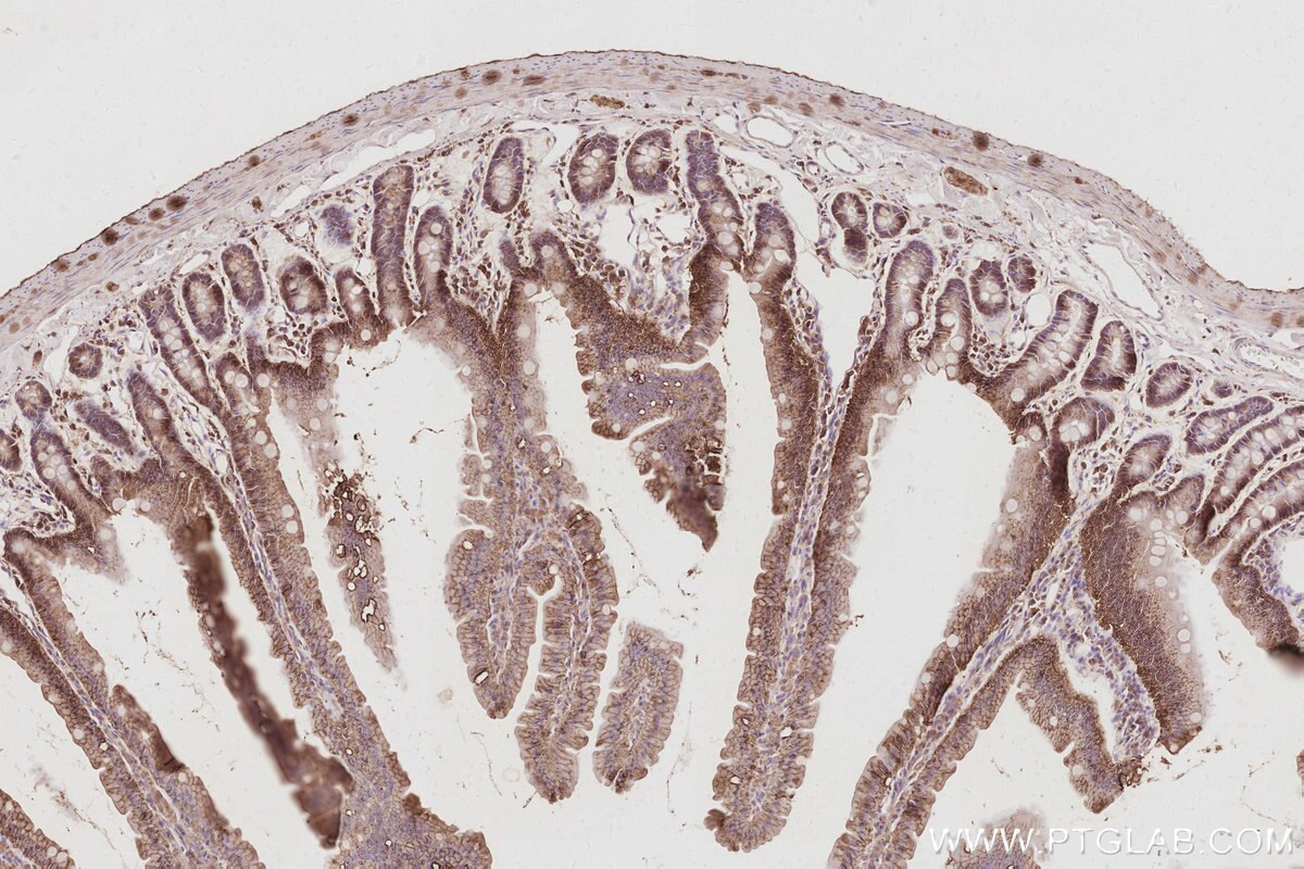 Immunohistochemical analysis of paraffin-embedded rat small intestine tissue slide using KHC3094 (SLC4A7/NBCn1 IHC Kit). Immunohistochemical analysis of paraffin-embedded rat small intestine tissue slide using KHC3094 (SLC4A7/NBCn1 IHC Kit).