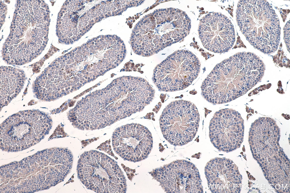 Immunohistochemical analysis of paraffin-embedded mouse testis tissue slide using KHC0267 (SLC8A1 IHC Kit).