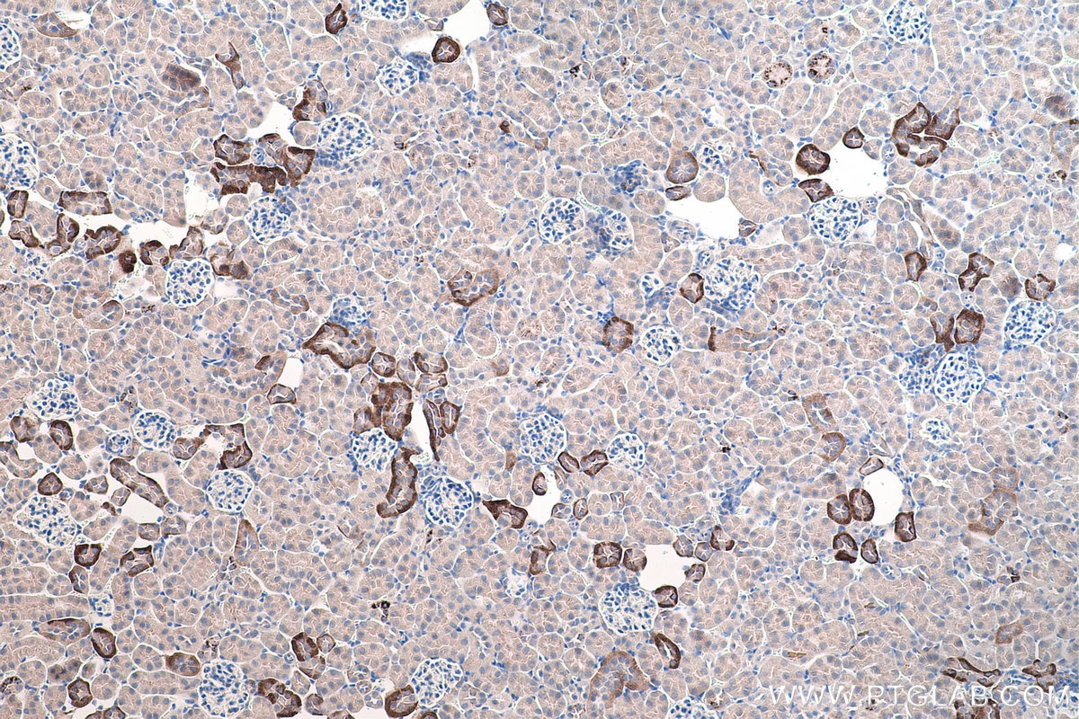 Immunohistochemical analysis of paraffin-embedded mouse kidney tissue slide using KHC0267 (SLC8A1 IHC Kit).