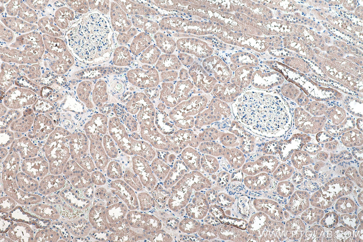 Immunohistochemical analysis of paraffin-embedded human kidney tissue slide using KHC0267 (SLC8A1 IHC Kit).