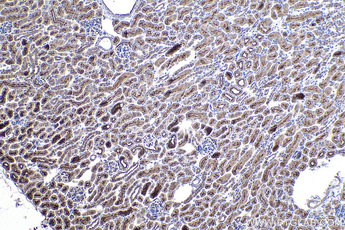 Immunohistochemical analysis of paraffin-embedded mouse kidney tissue slide using KHC0891 (SLC9A3R1 IHC Kit).