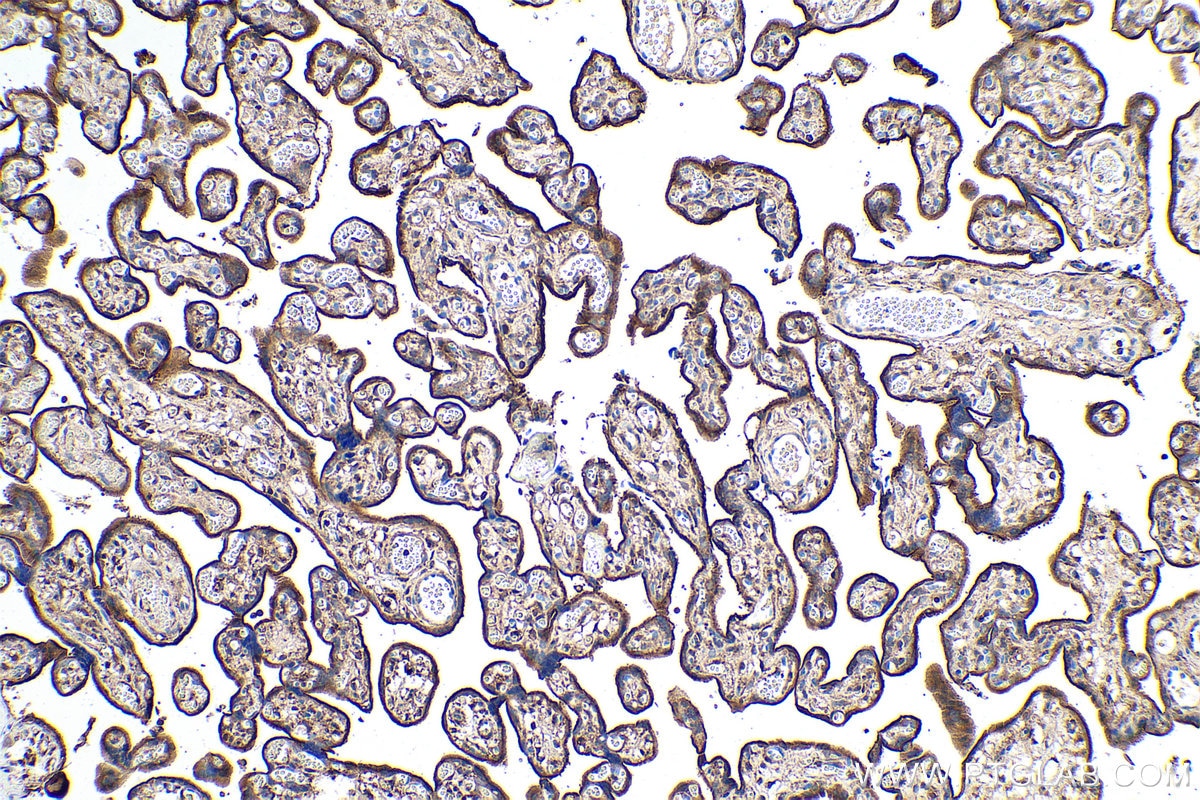 Immunohistochemical analysis of paraffin-embedded human placenta tissue slide using KHC0891 (SLC9A3R1 IHC Kit).