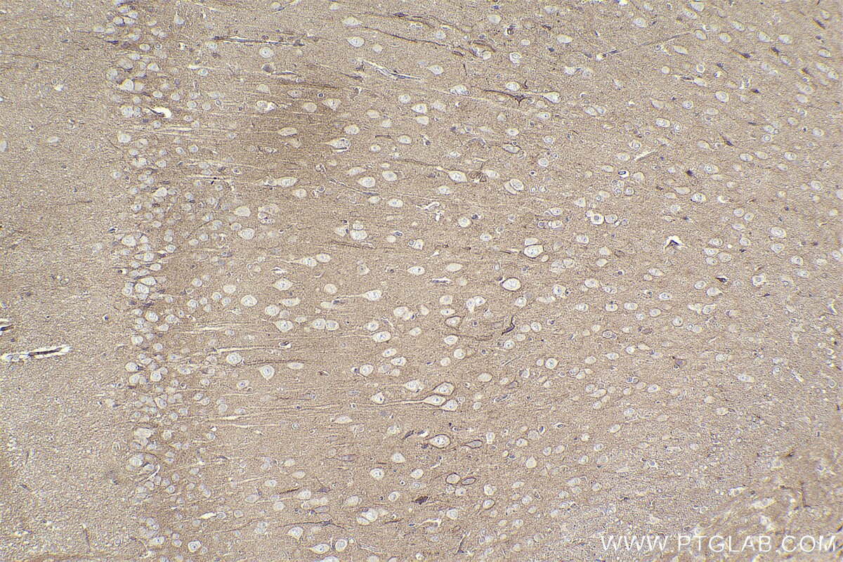 Immunohistochemical analysis of paraffin-embedded rat brain tissue slide using KHC2277 (SLCO1A2 IHC Kit).