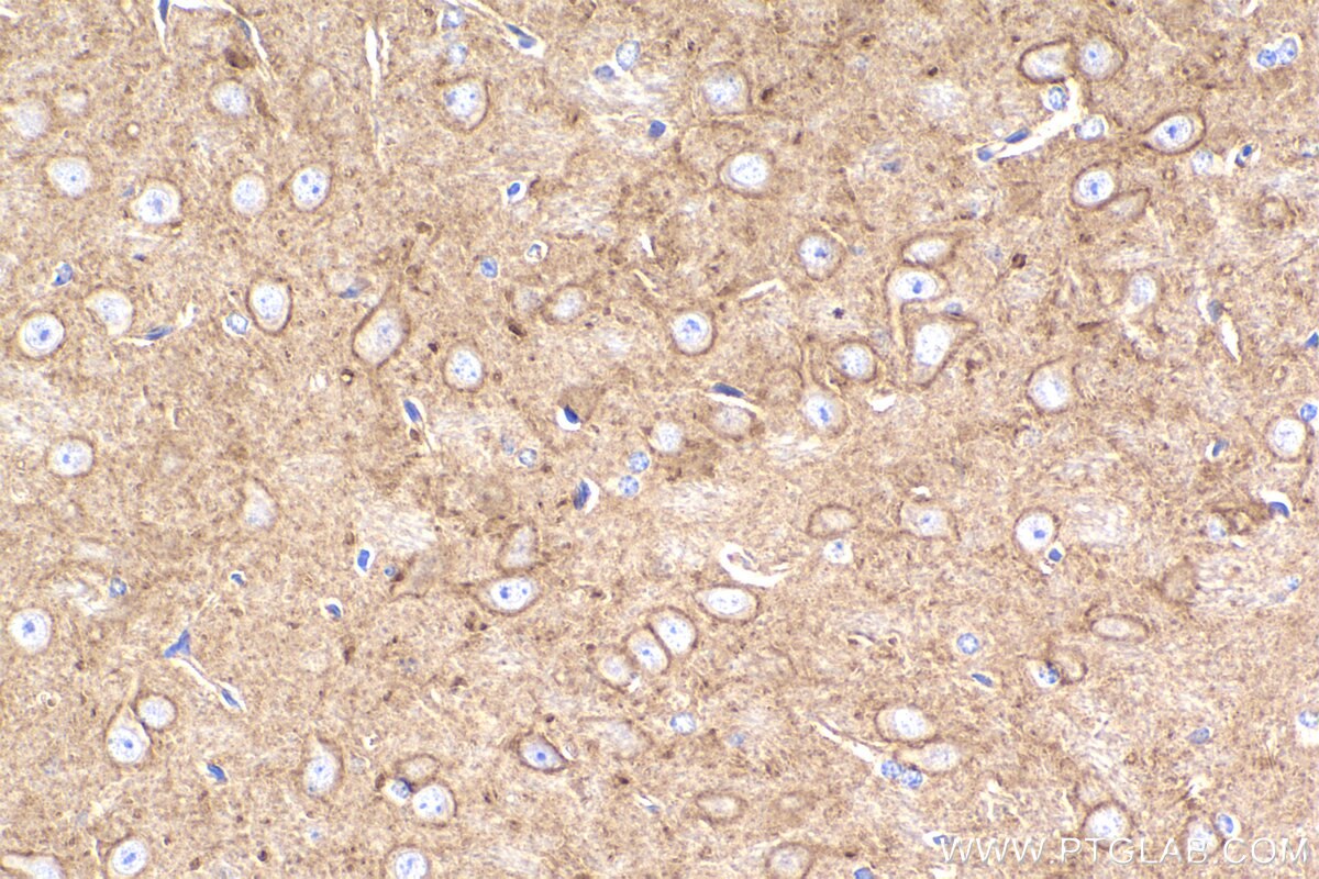 Immunohistochemical analysis of paraffin-embedded mouse brain tissue slide using KHC2277 (SLCO1A2 IHC Kit).