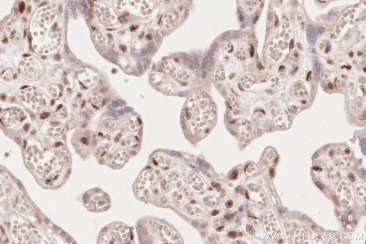 Immunohistochemical analysis of paraffin-embedded human placenta tissue slide using KHC2629 (SLFN11 IHC Kit).
