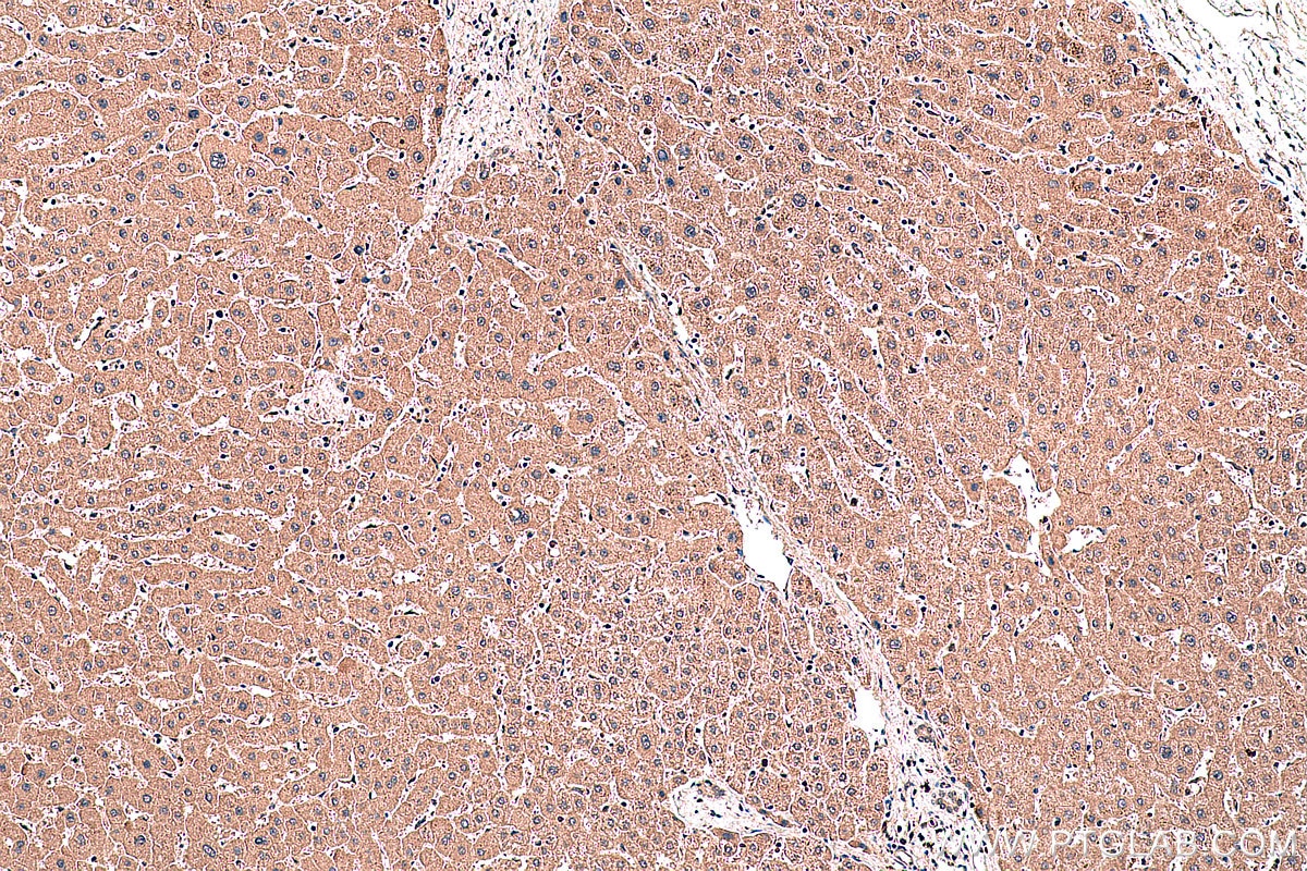 Immunohistochemical analysis of paraffin-embedded human liver tissue slide using KHC0389 (SMAD1 IHC Kit).