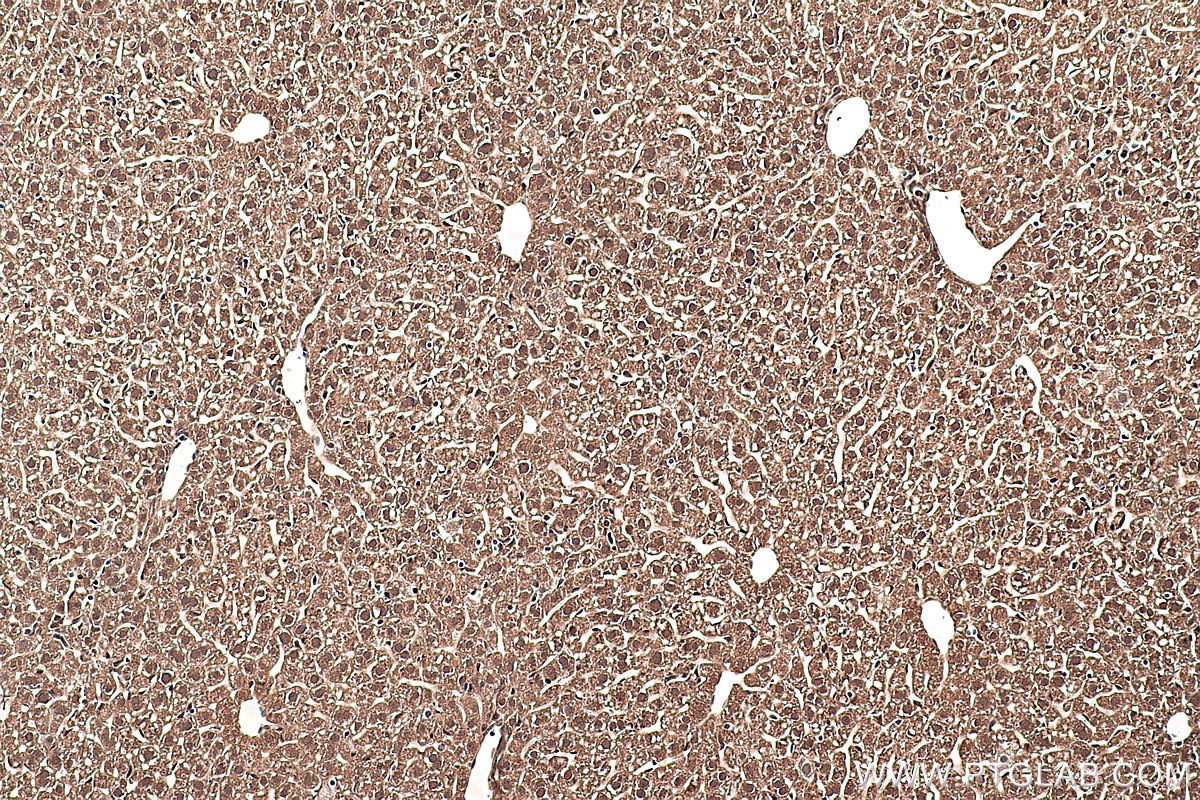 Immunohistochemical analysis of paraffin-embedded mouse liver tissue slide using KHC0389 (SMAD1 IHC Kit).