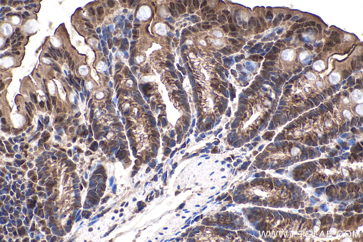Immunohistochemical analysis of paraffin-embedded mouse colon tissue slide using KHC0126 (SMAD2 IHC Kit).