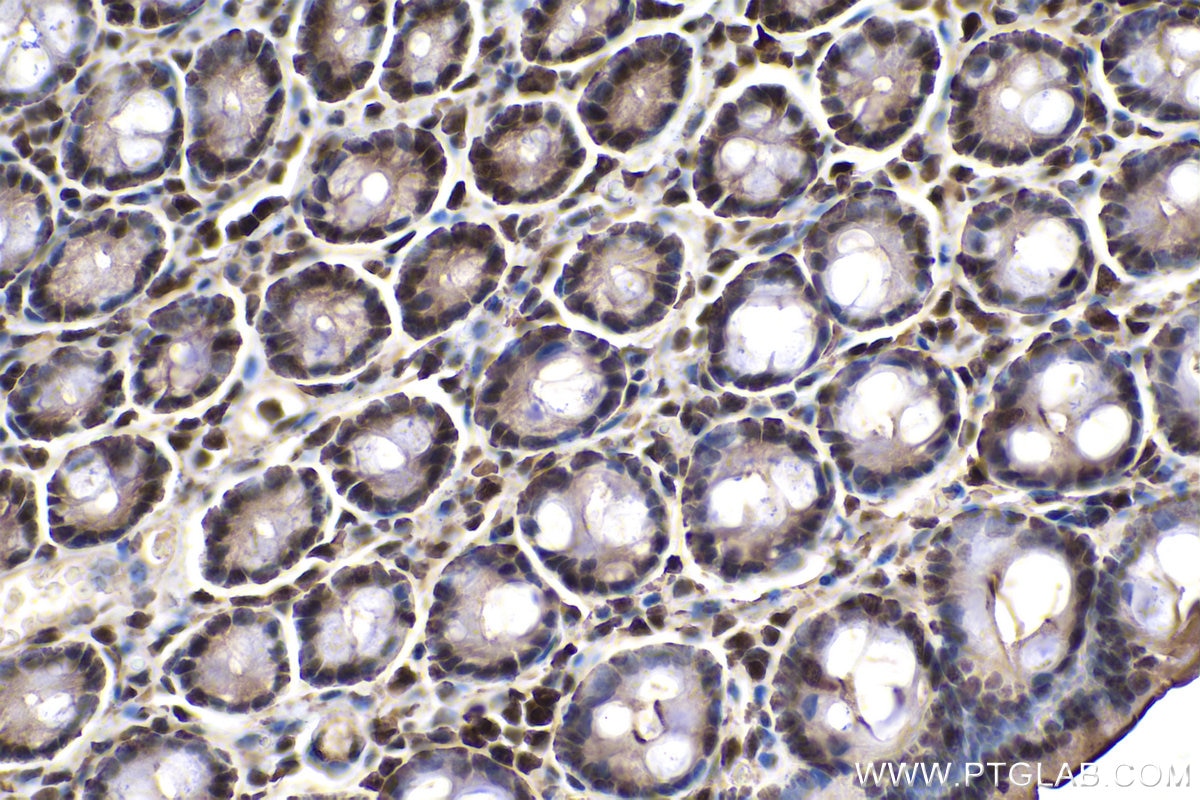 Immunohistochemical analysis of paraffin-embedded rat colon tissue slide using KHC0126 (SMAD2 IHC Kit).