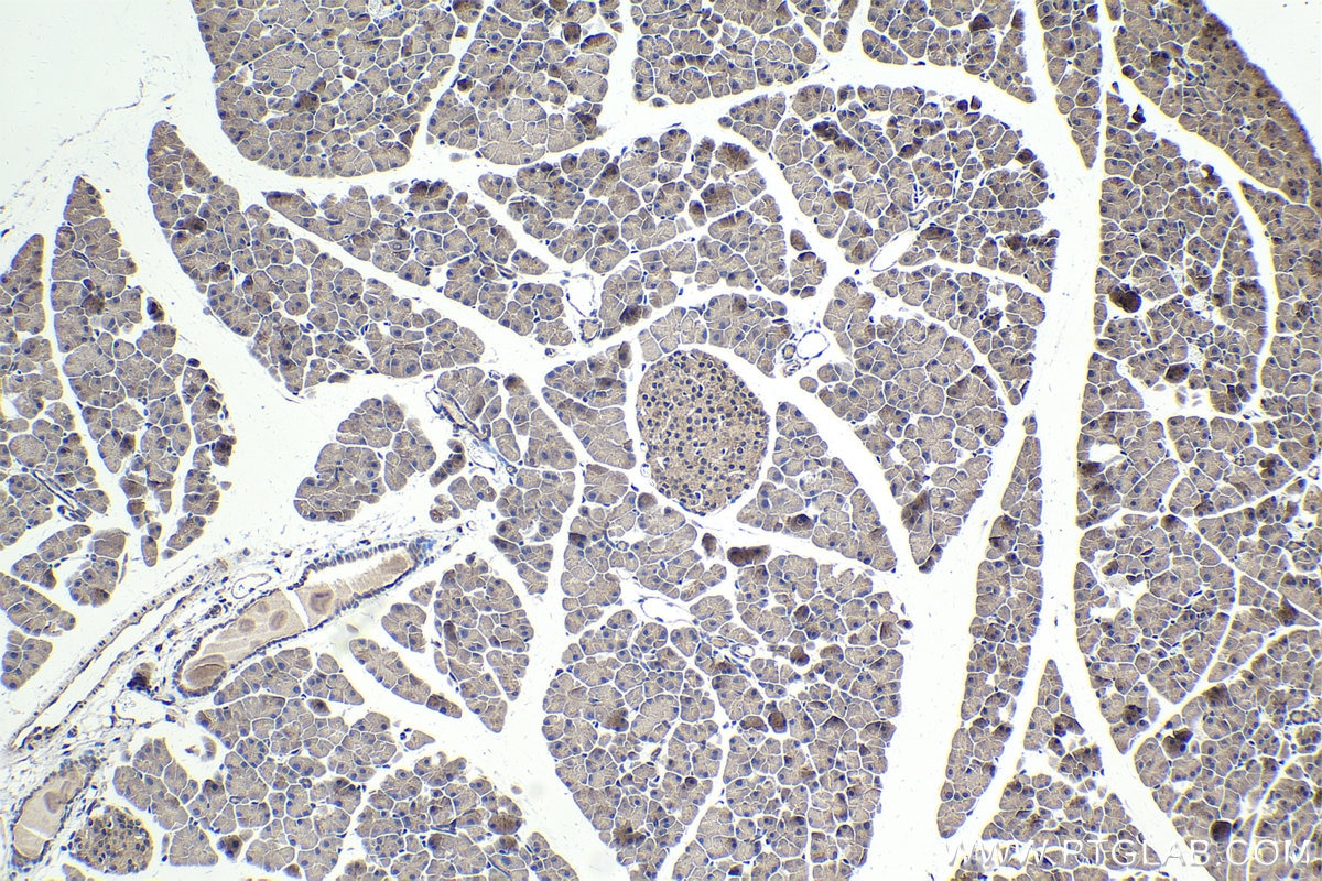 Immunohistochemical analysis of paraffin-embedded mouse pancreas tissue slide using KHC1713 (SMAD4 IHC Kit).
