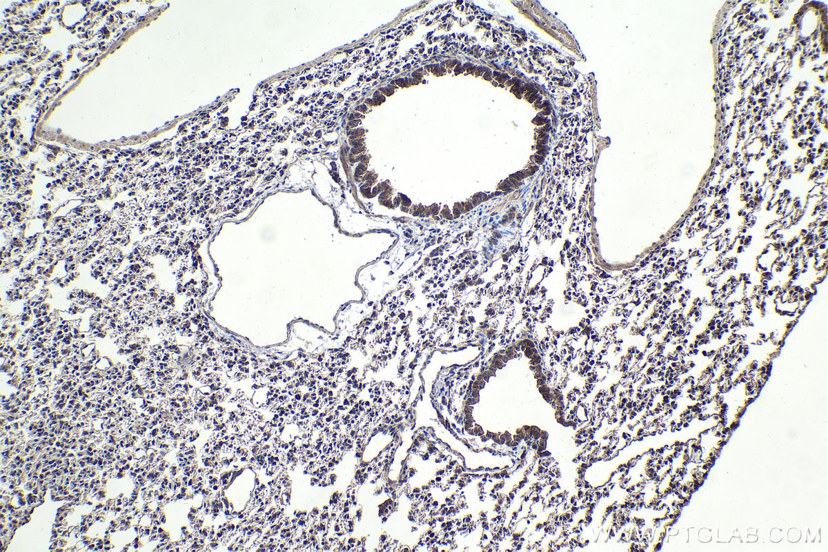 Immunohistochemical analysis of paraffin-embedded mouse lung tissue slide using KHC1713 (SMAD4 IHC Kit).