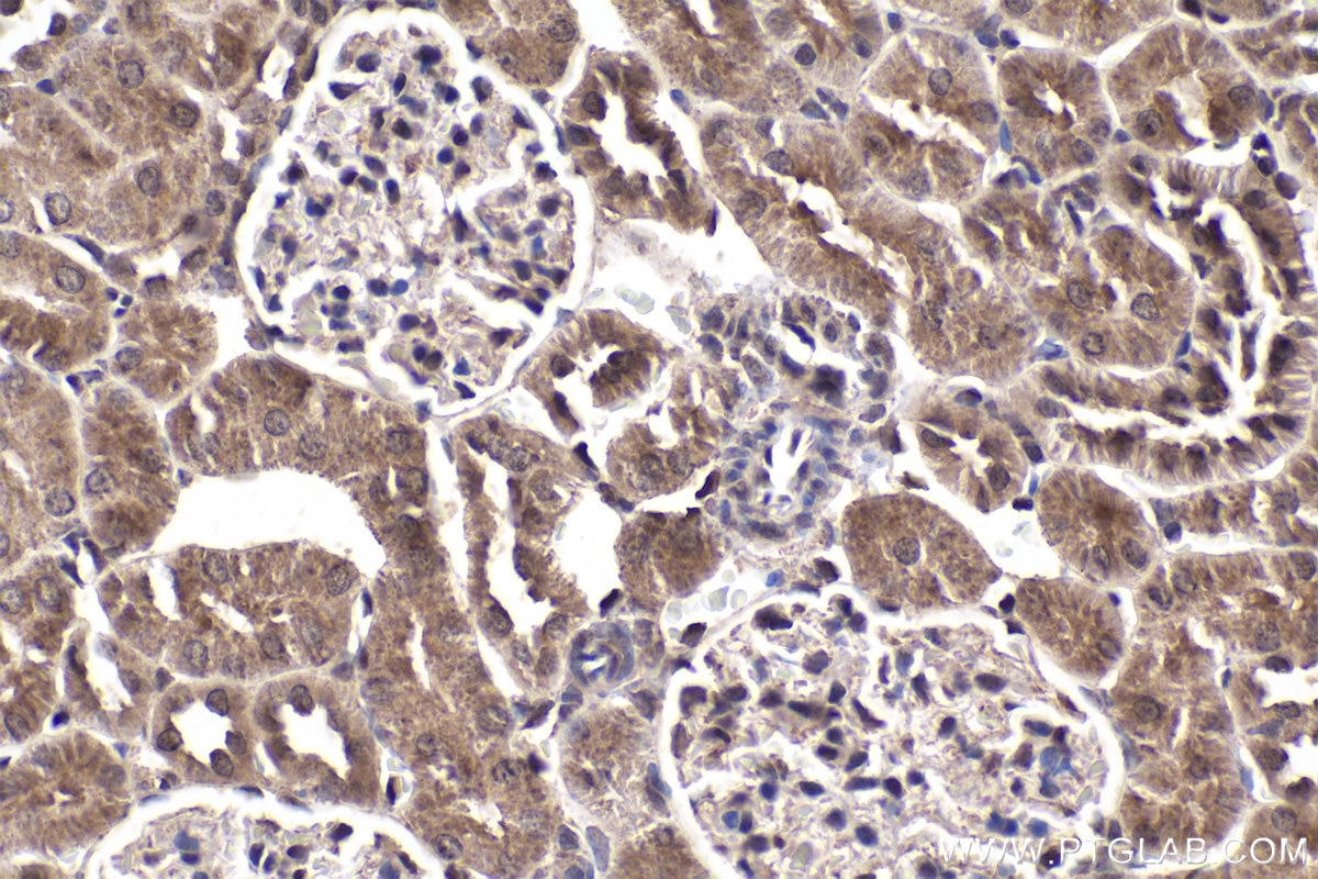 Immunohistochemical analysis of paraffin-embedded rat kidney tissue slide using KHC1895 (SMAD5 IHC Kit).
