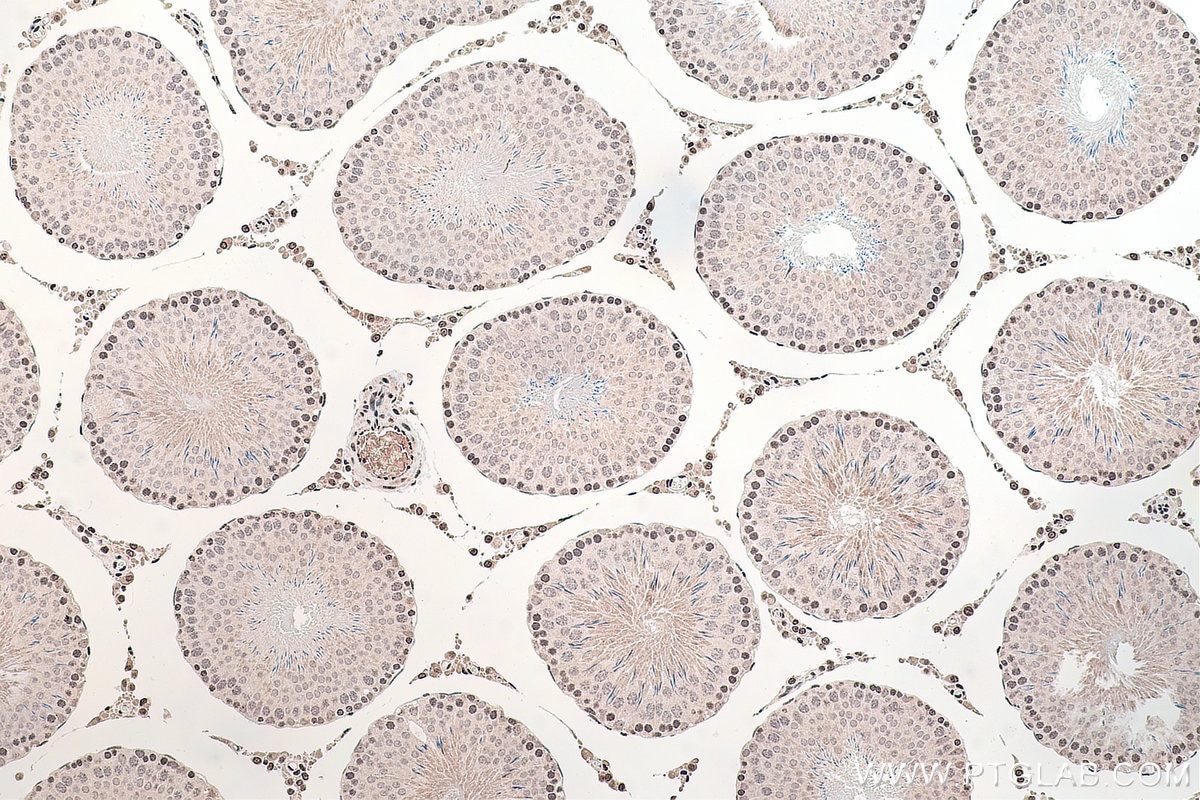 Immunohistochemical analysis of paraffin-embedded rat testis tissue slide using KHC0127 (SMAD7 IHC Kit).