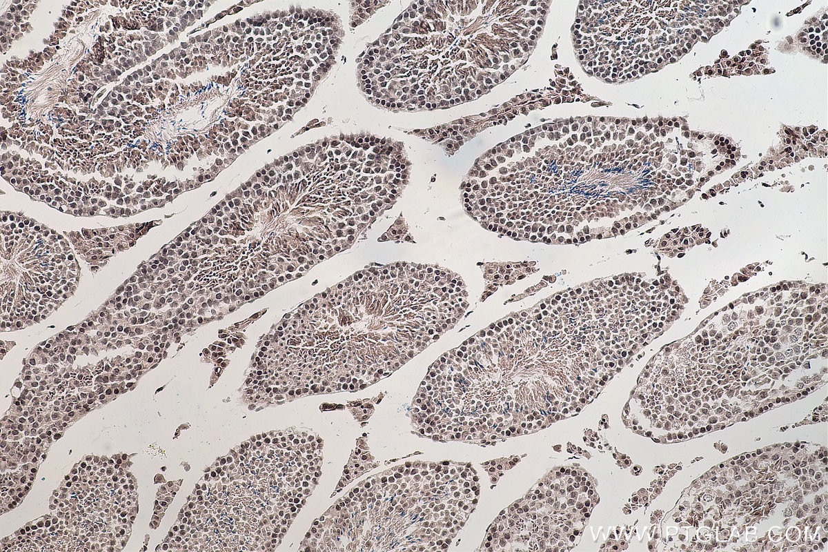 Immunohistochemical analysis of paraffin-embedded mouse testis tissue slide using KHC0127 (SMAD7 IHC Kit).