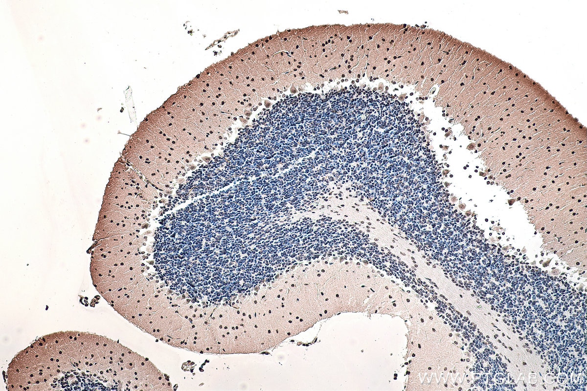 Immunohistochemical analysis of paraffin-embedded mouse cerebellum tissue slide using KHC0127 (SMAD7 IHC Kit).