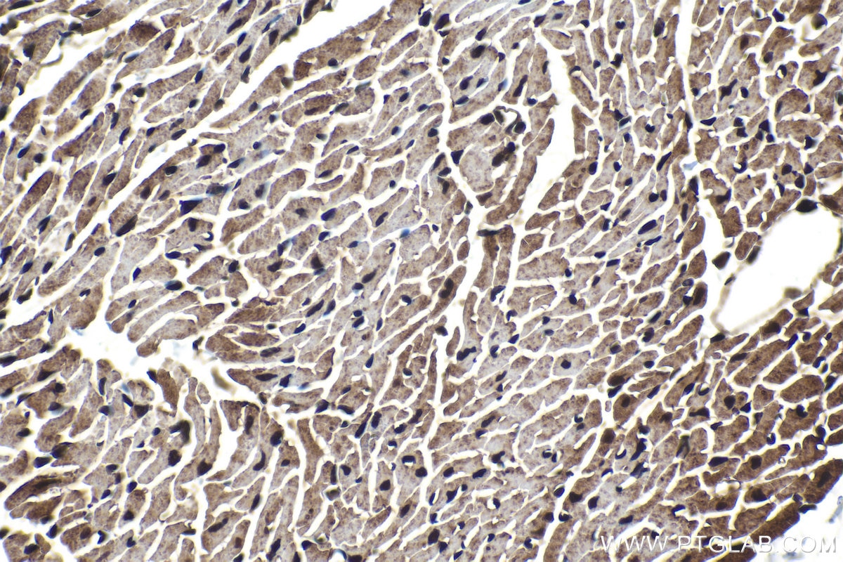 Immunohistochemical analysis of paraffin-embedded mouse heart tissue slide using KHC1441 (SMAD9 IHC Kit).