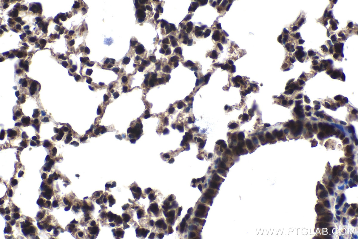 Immunohistochemical analysis of paraffin-embedded mouse lung tissue slide using KHC1441 (SMAD9 IHC Kit).