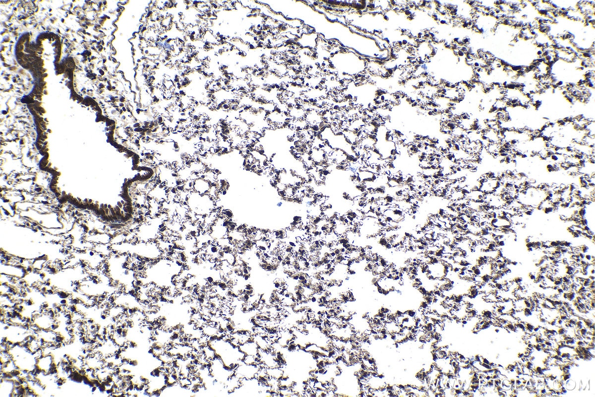 Immunohistochemical analysis of paraffin-embedded rat lung tissue slide using KHC1441 (SMAD9 IHC Kit).