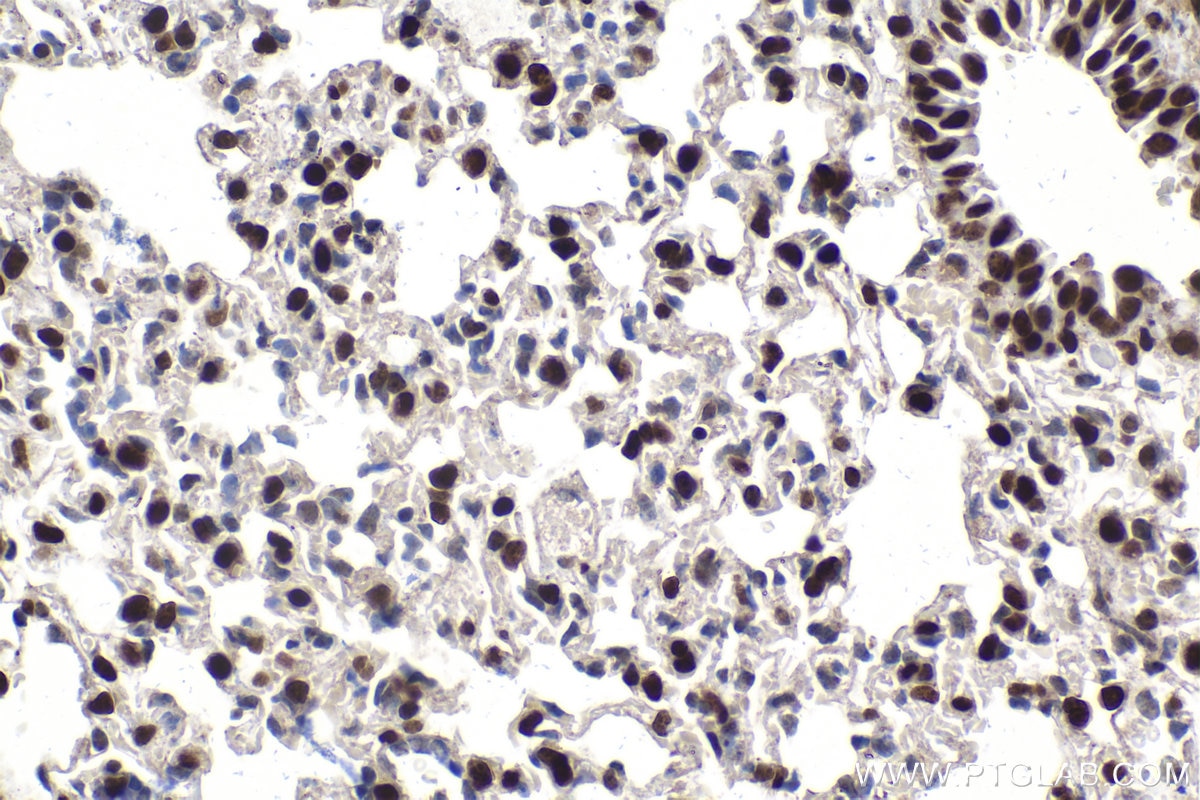 Immunohistochemical analysis of paraffin-embedded mouse lung tissue slide using KHC1574 (SMARCA1/SNF2L IHC Kit).
