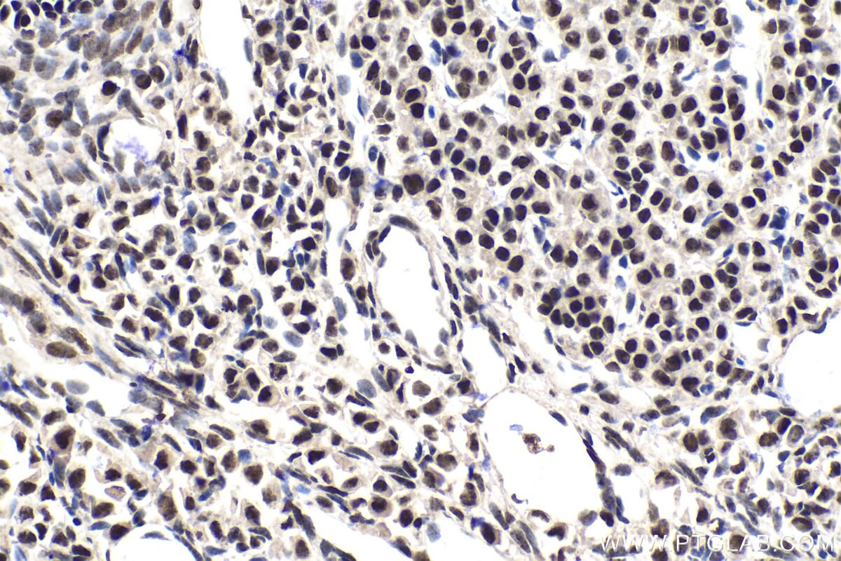 Immunohistochemical analysis of paraffin-embedded mouse ovary tissue slide using KHC1574 (SMARCA1/SNF2L IHC Kit).