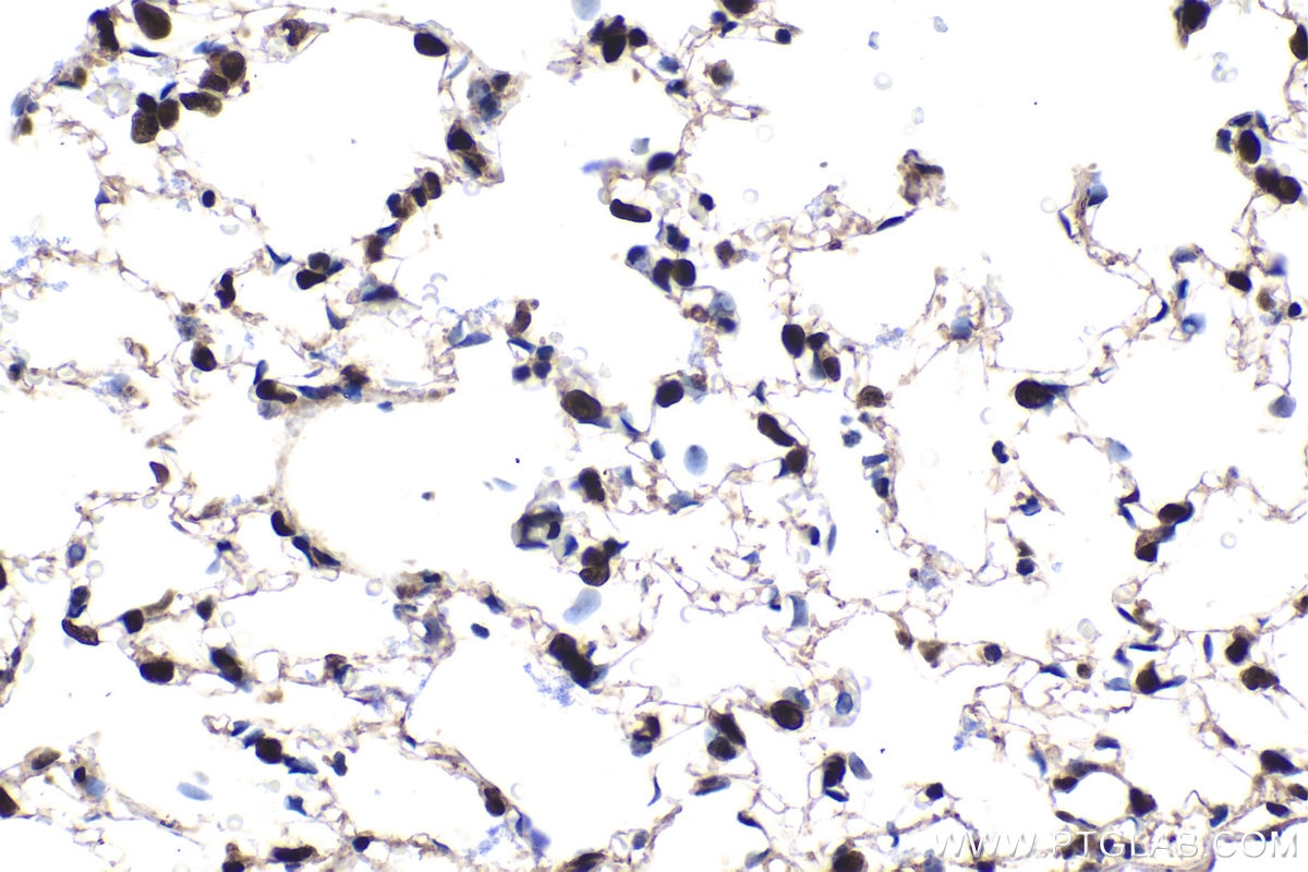Immunohistochemical analysis of paraffin-embedded rat lung tissue slide using KHC1574 (SMARCA1/SNF2L IHC Kit).