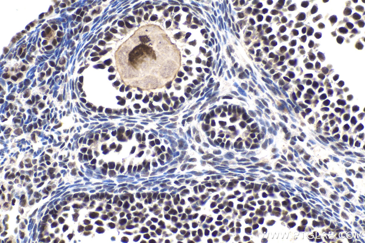 Immunohistochemical analysis of paraffin-embedded mouse ovary tissue slide using KHC1618 (SMARCA2 IHC Kit).
