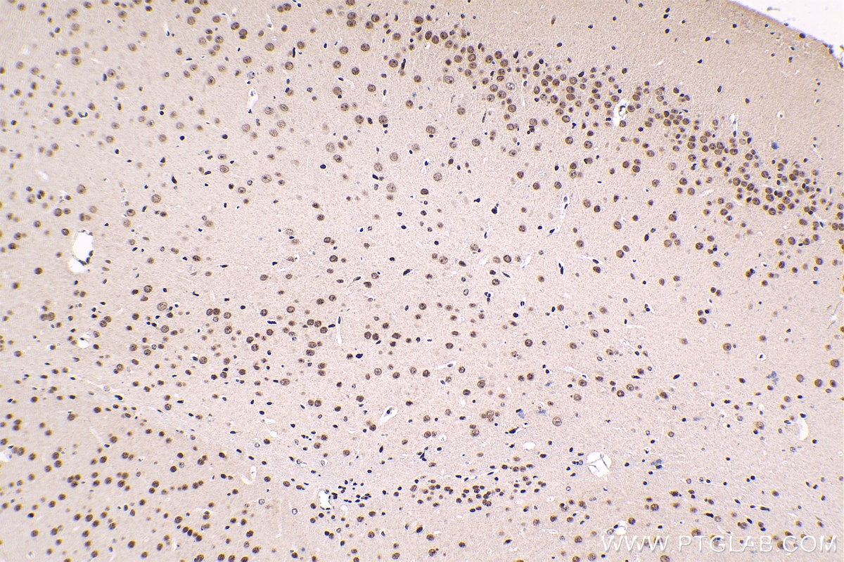 Immunohistochemical analysis of paraffin-embedded mouse brain tissue slide using KHC1618 (SMARCA2 IHC Kit).