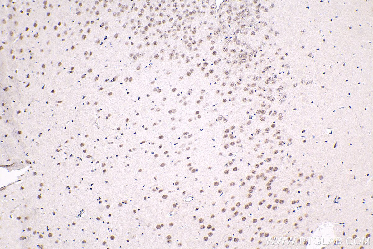 Immunohistochemical analysis of paraffin-embedded rat brain tissue slide using KHC1618 (SMARCA2 IHC Kit).