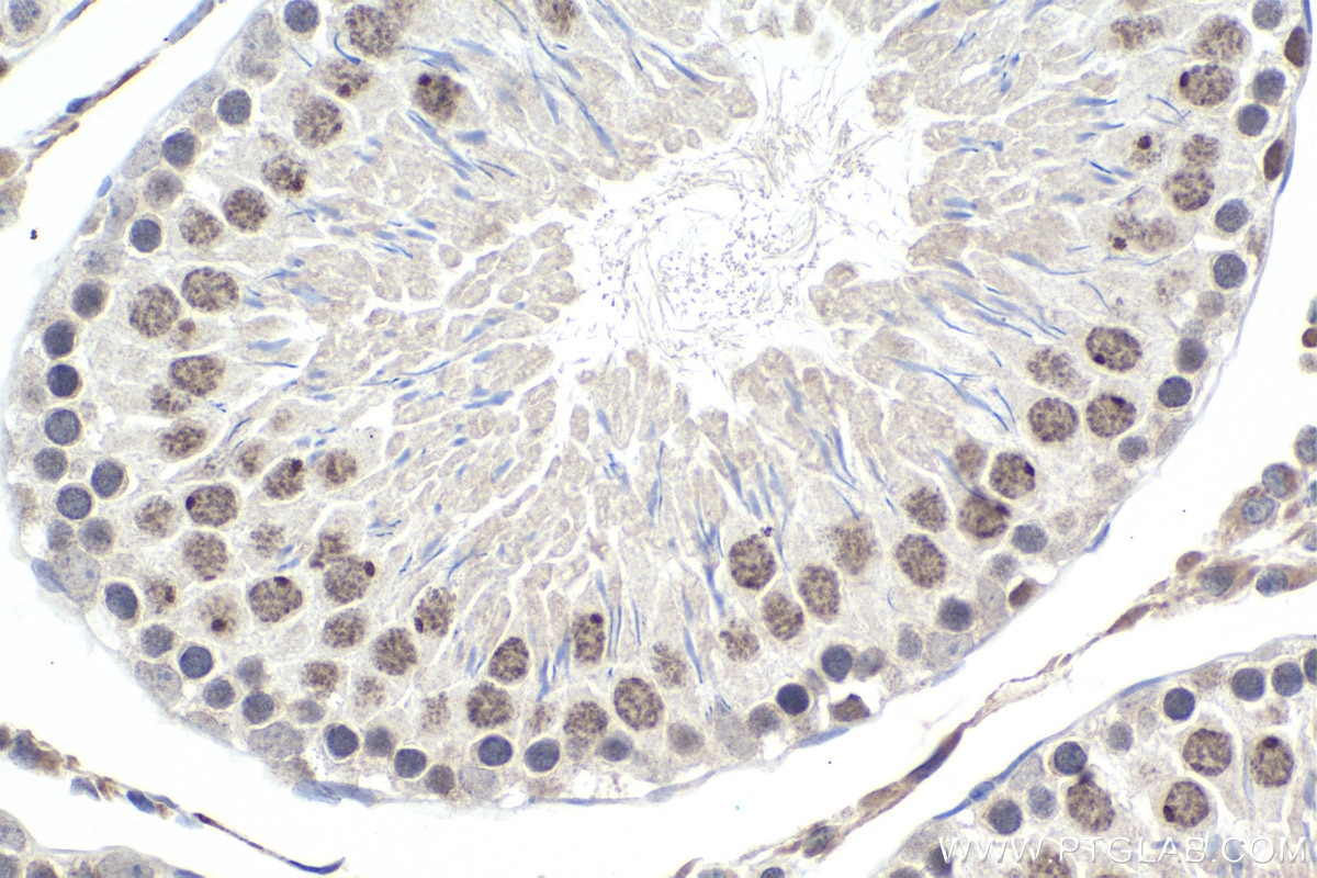 Immunohistochemical analysis of paraffin-embedded rat testis tissue slide using KHC1463 (SMARCA5 IHC Kit).