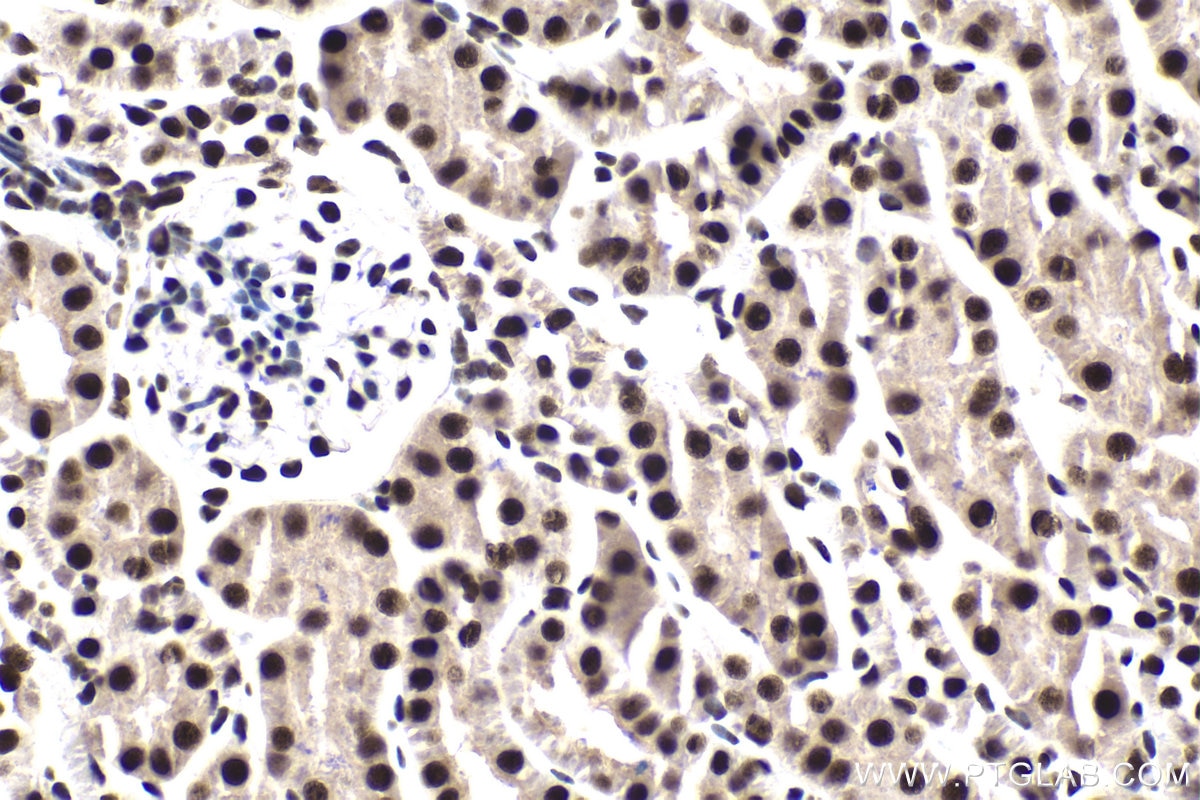 Immunohistochemical analysis of paraffin-embedded mouse kidney tissue slide using KHC1860 (SMARCC1 IHC Kit).