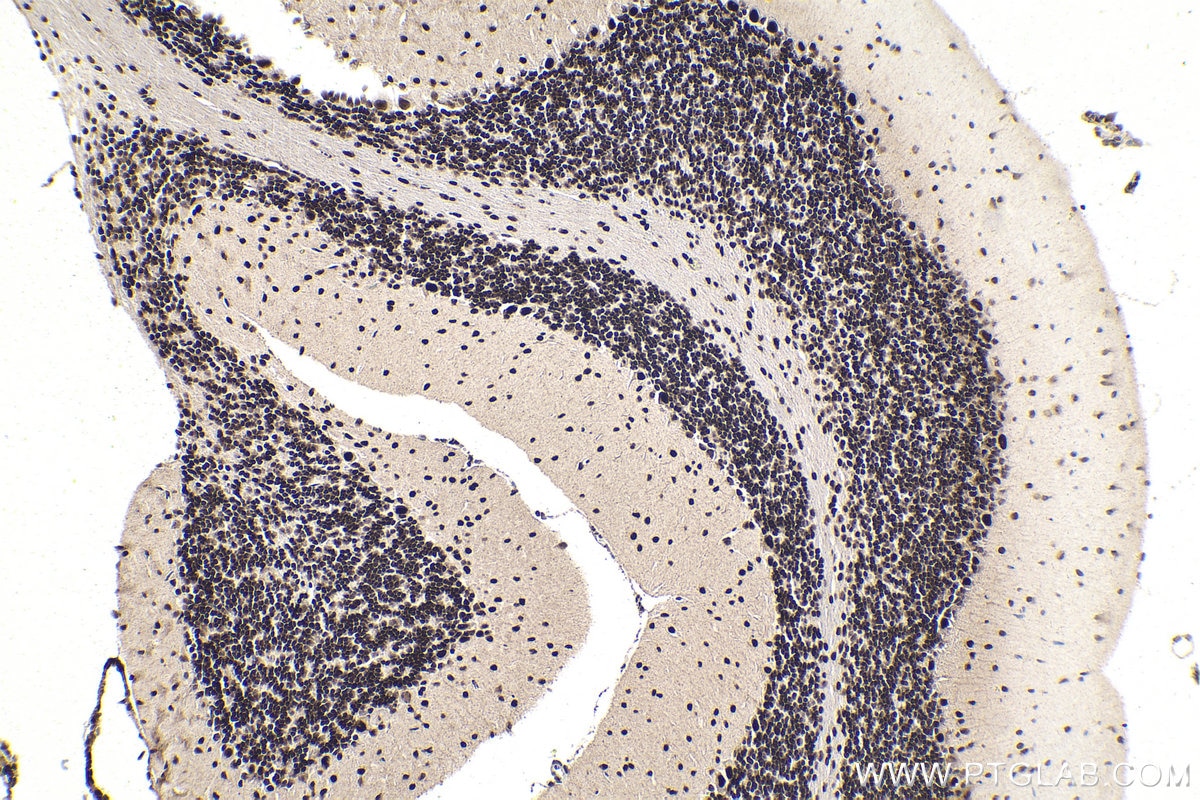Immunohistochemical analysis of paraffin-embedded mouse cerebellum tissue slide using KHC1860 (SMARCC1 IHC Kit).