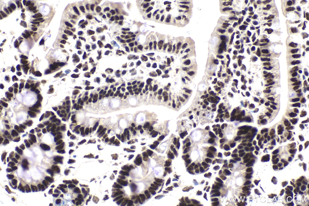 Immunohistochemical analysis of paraffin-embedded mouse small intestine tissue slide using KHC1860 (SMARCC1 IHC Kit).