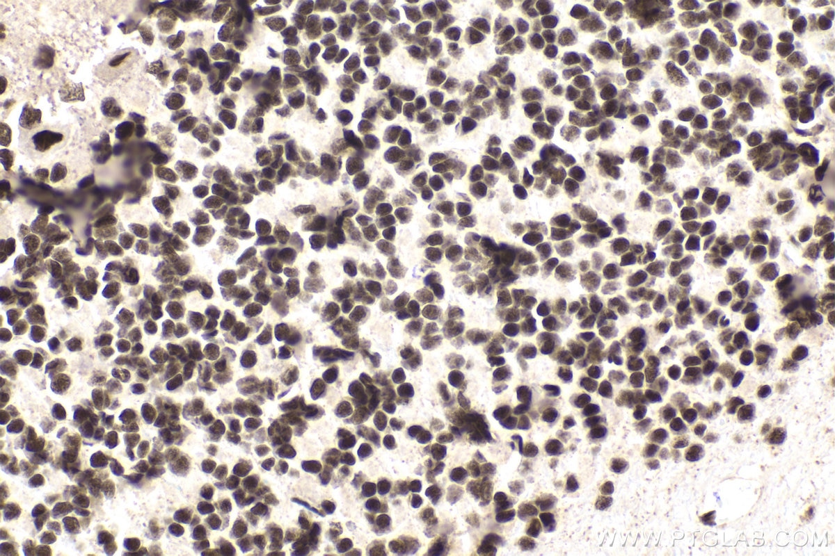 Immunohistochemical analysis of paraffin-embedded rat cerebellum tissue slide using KHC1860 (SMARCC1 IHC Kit).