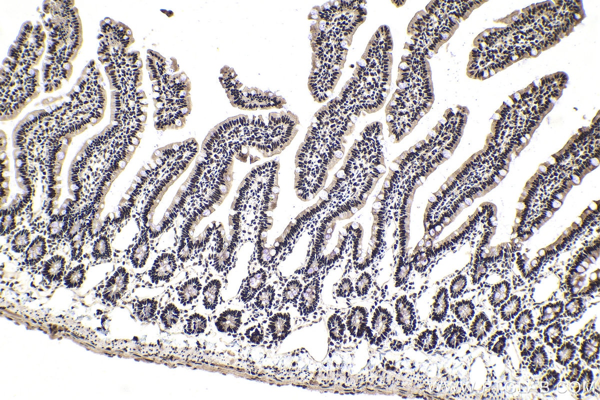 Immunohistochemical analysis of paraffin-embedded rat small intestine tissue slide using KHC1860 (SMARCC1 IHC Kit).