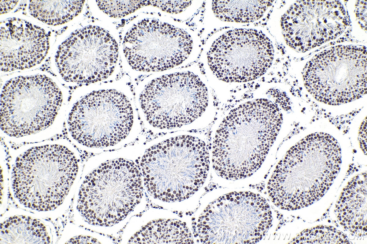 Immunohistochemical analysis of paraffin-embedded rat testis tissue slide using KHC1860 (SMARCC1 IHC Kit).