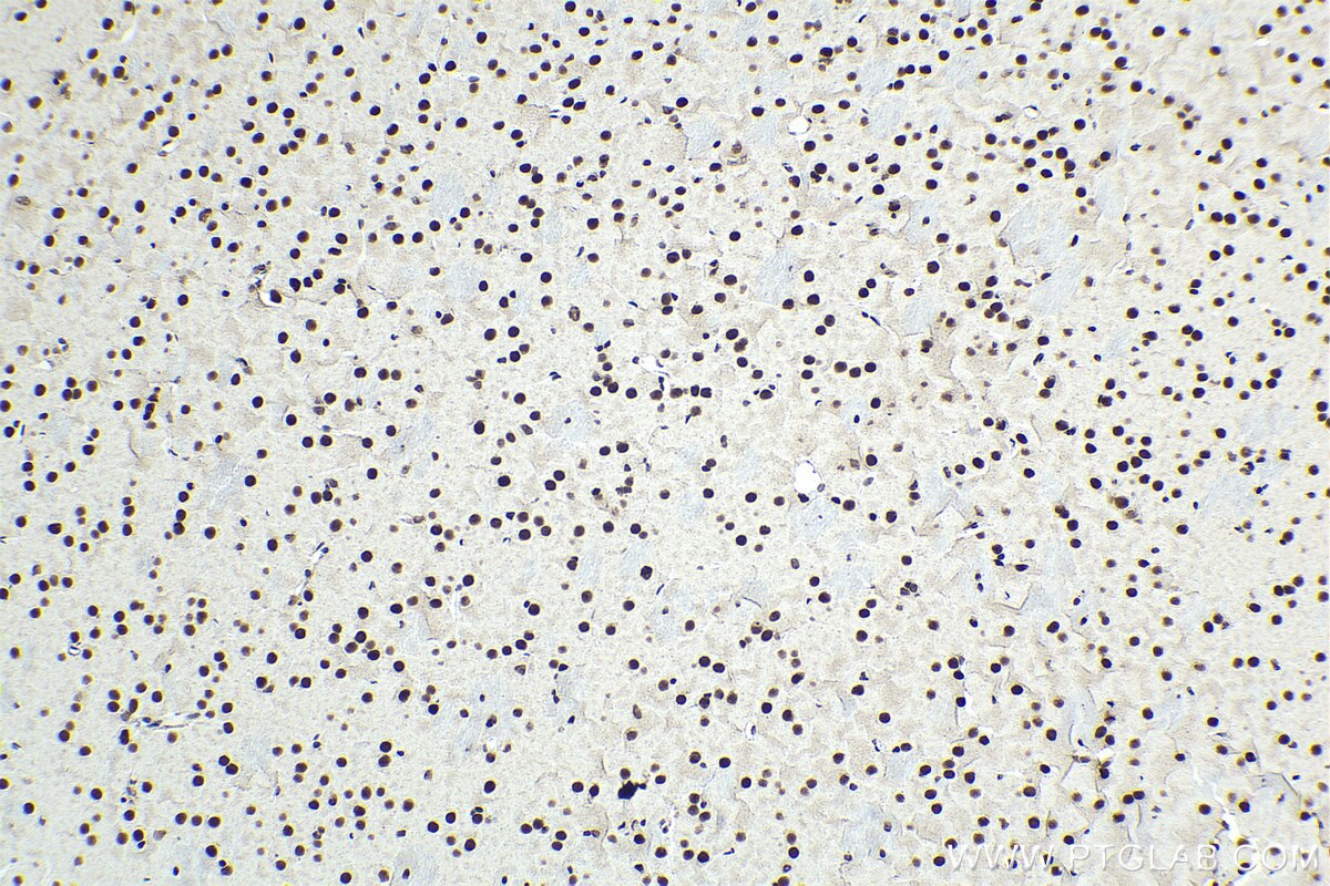 Immunohistochemical analysis of paraffin-embedded mouse brain tissue slide using KHC1398 (SMARCC2 IHC Kit).