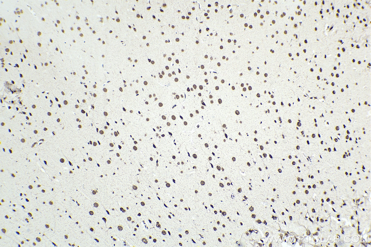 Immunohistochemical analysis of paraffin-embedded rat brain tissue slide using KHC1398 (SMARCC2 IHC Kit).