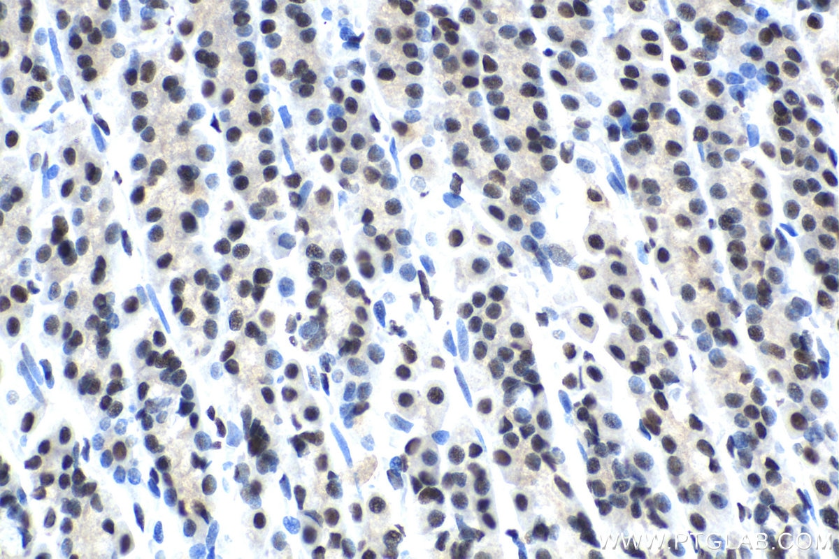 Immunohistochemical analysis of paraffin-embedded rat stomach tissue slide using KHC1398 (SMARCC2 IHC Kit).